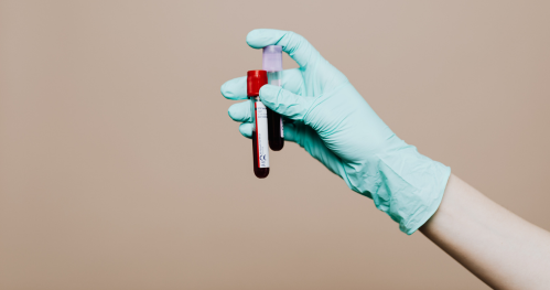 Bilan sans ordonnance - Groupe sanguin