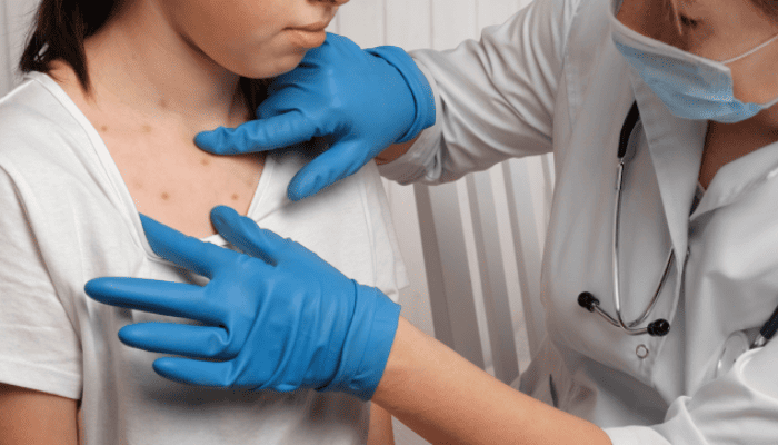 Le virus Mpox ou « Variole du Singe », c'est quoi exactement ?